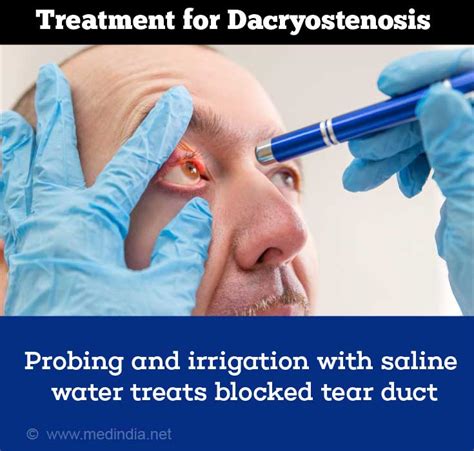 saline solution for tear duct